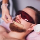 How to epilate your beard?